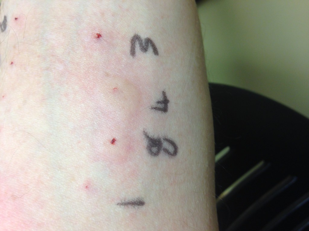 Are you Allergic to Mold? Dog Gone Mold